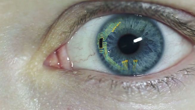 go to Kontaktlinsen: Das unterschätzte Müllproblem